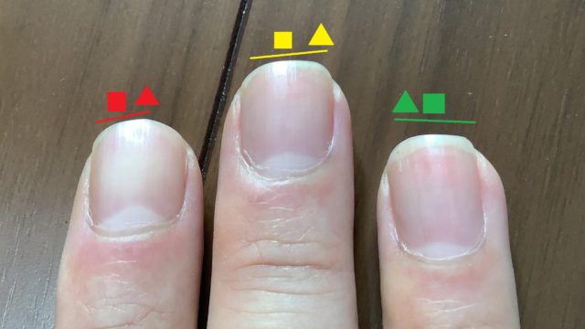 劇的に爪の形が変わったので解説する クラシックギターの世界